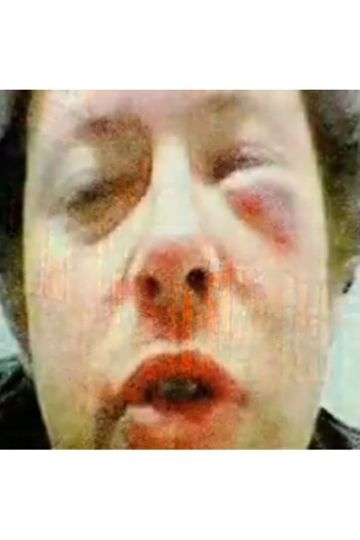 Stalking Pete Doherty