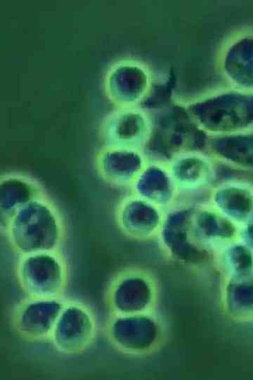 ERYTHROPOIEISIS AND ERYTHROPOIETIN Poster