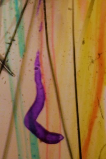 Visions From My Scalp