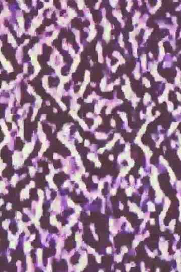 ............ (ellipsis, ellipsis, ellipsis...) Poster