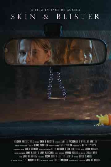 Skin & Blister Poster