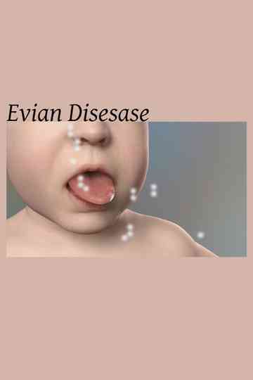 Evian Disesase Poster