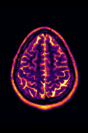 Conclusion: Stable Disease Poster