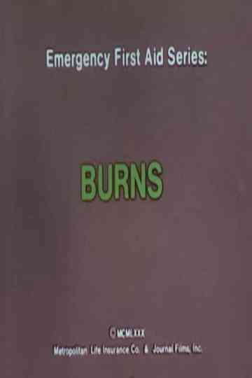 Emergency First Aid Series: Burns Poster