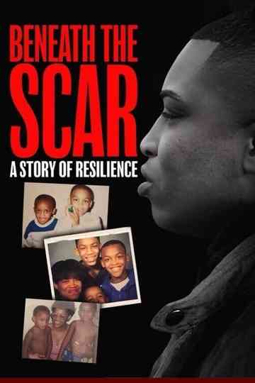 Beneath the Scar: A Story of Resilience Poster
