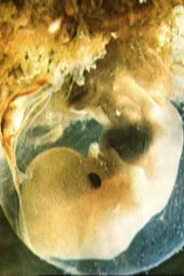 Schwangerschaft und Geburt Poster