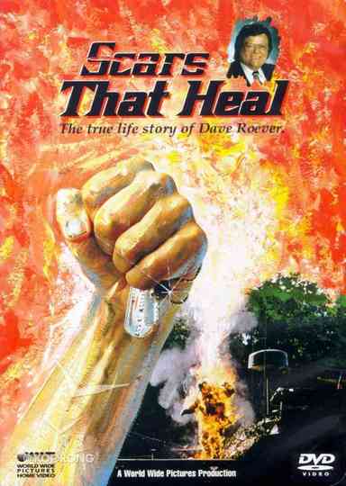 Scars That Heal: The Dave Roever Story Poster