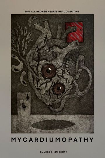 Mycardiumopathy