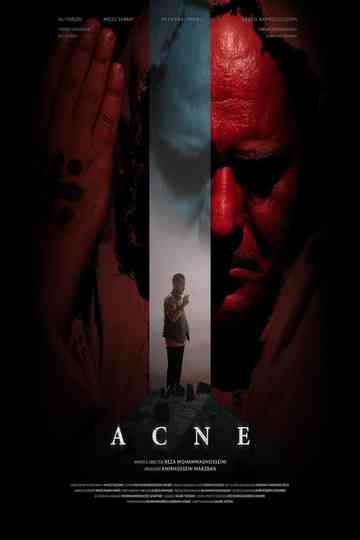 Acne Poster