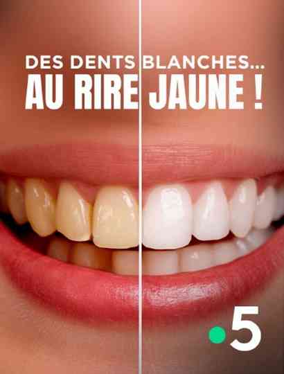 Des dents blanches au rire jaune Poster