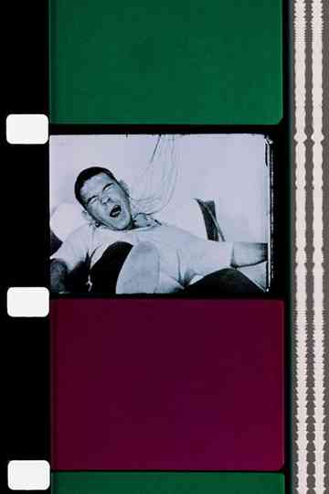 Epileptic Seizure Comparison Poster