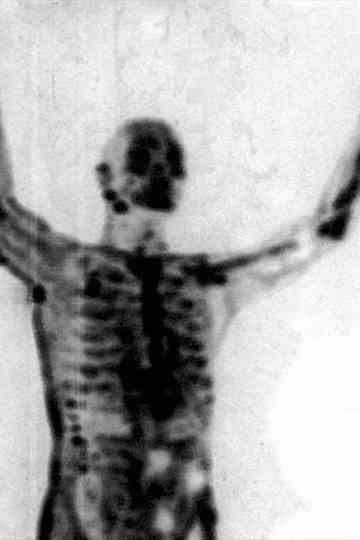 The Radio Wave of Blood Beneath the Dirt Ice and Flowers Poster