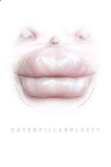 Caterpillarplasty poster