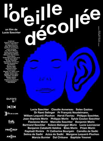 Loreille décollée