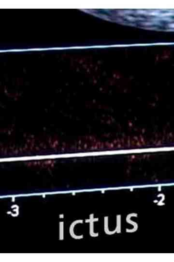 Ictus Poster