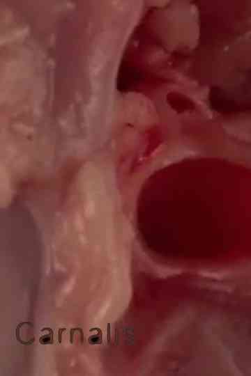 Carnalis Poster