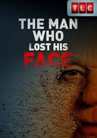 The Man Who Lost His Face Poster