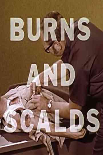 Burns And Scalds Poster