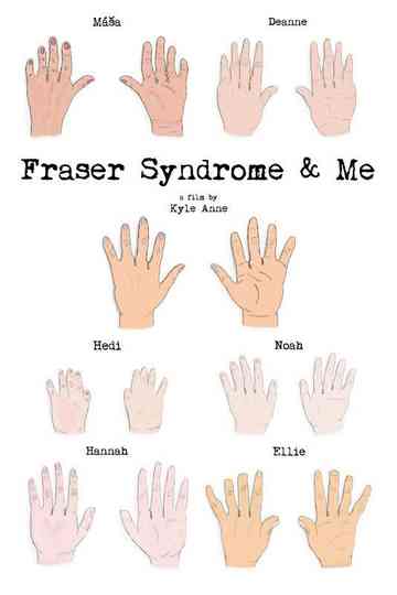 Fraser Syndrome  Me Poster