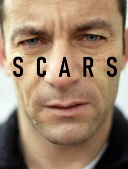 Scars